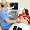 4D Baby Scan