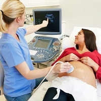 4D Baby Scan